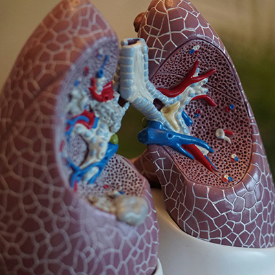 PULMONOLÓGIA